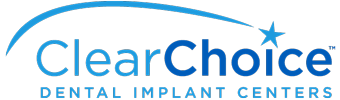 Is clear choice good for implants?