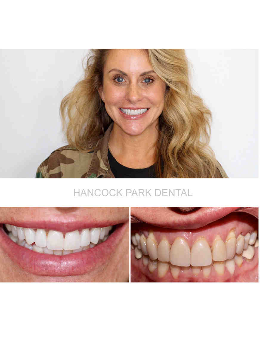 Is cosmetic dentistry bad for your teeth?