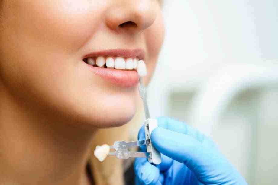 Is There A Dental Plan That Covers Implants Dental News Network