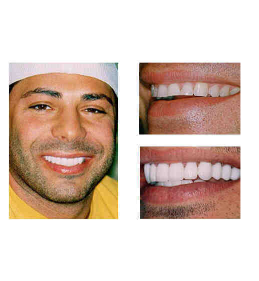 Cosmetic dentistry teeth grinding Dental News Network