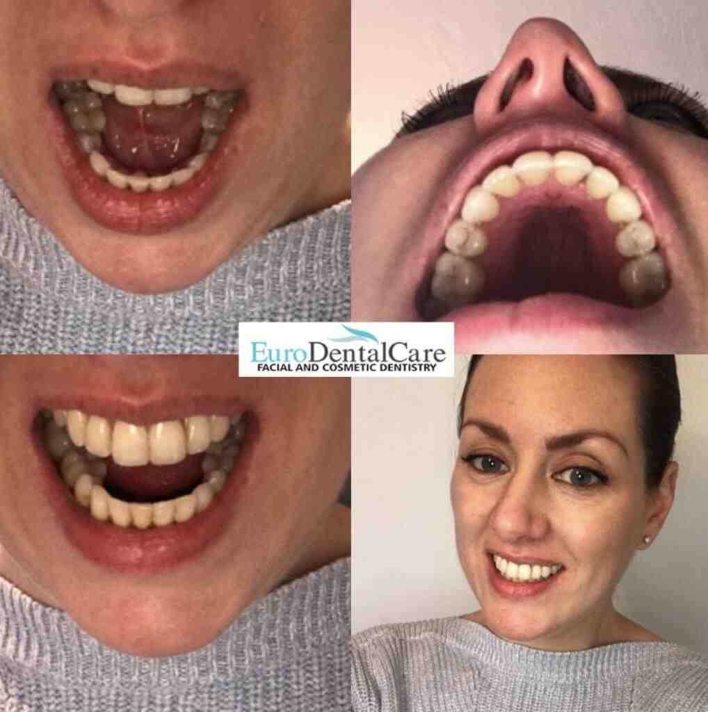 Cosmetic dentistry reddit Dental News Network