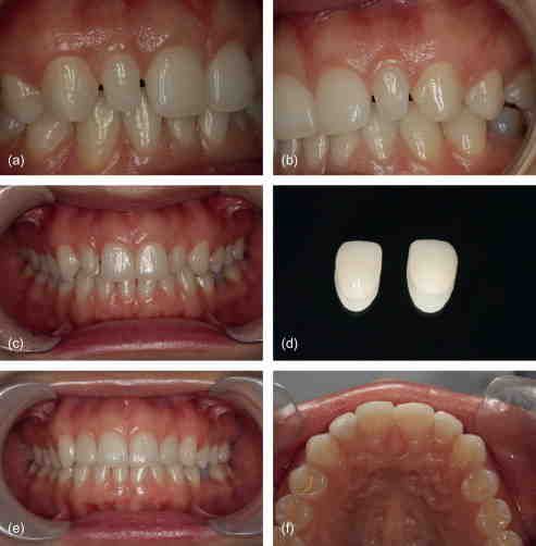 What can a cosmetic dentist do?