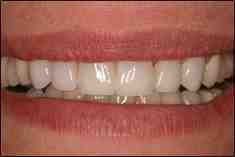 What can dentist give you to relax?