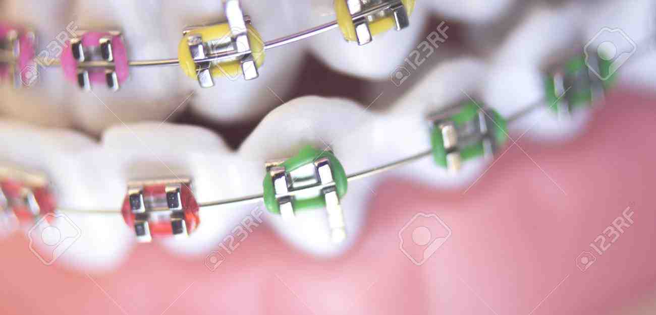 What certifications should a cosmetic surgeon have?