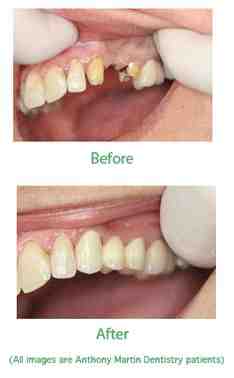 What disease does Missy Elliott have?