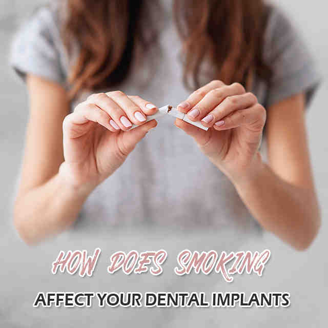 What does smoking do to teeth implants?