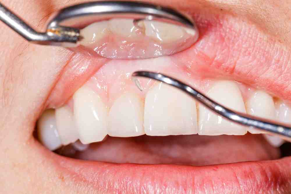 What falls under cosmetic dentistry?