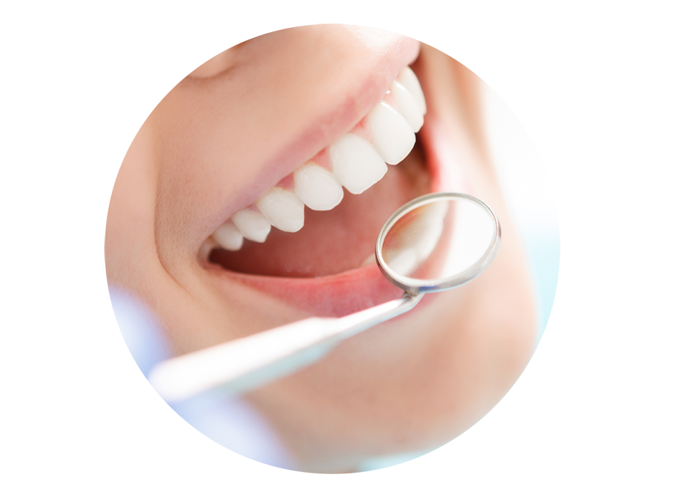 What glue is used for dental implants?