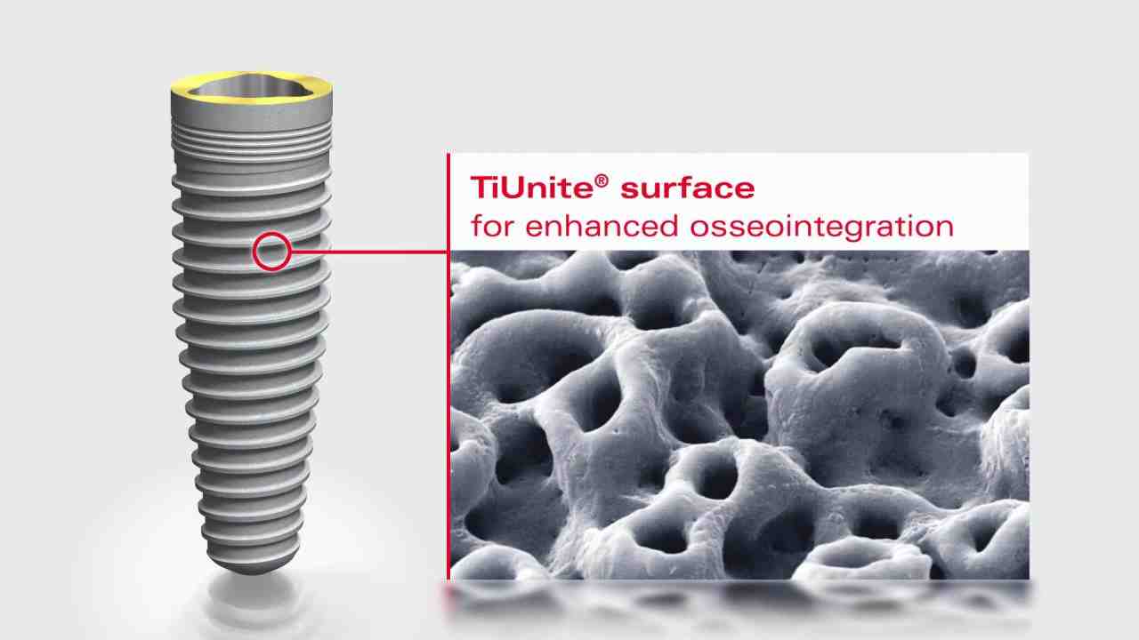What implant system is compatible with Nobel Biocare?