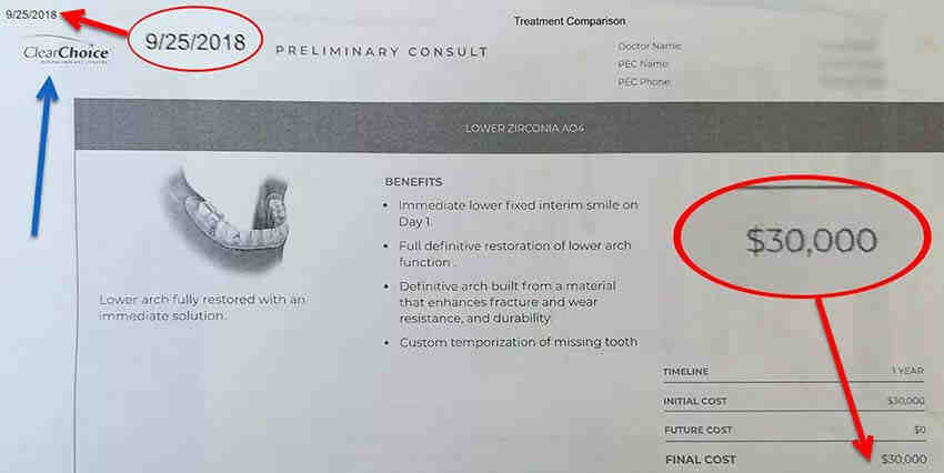 What is a reasonable price for dental implants?