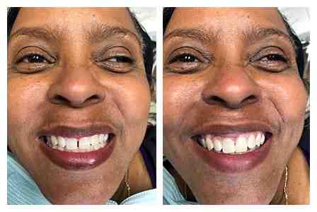 What is new in cosmetic dentistry?