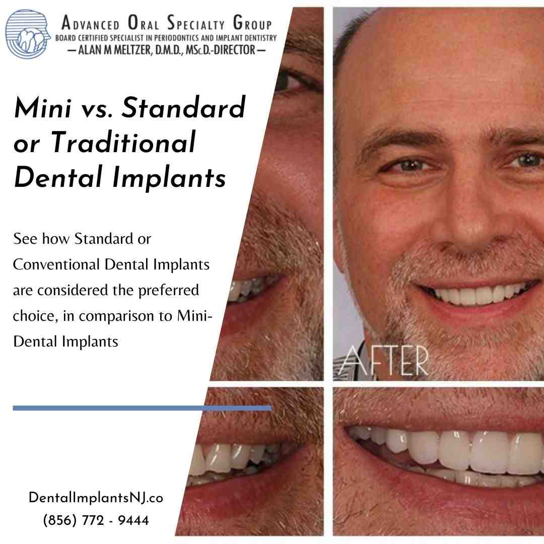 What is the average cost of mini implants?