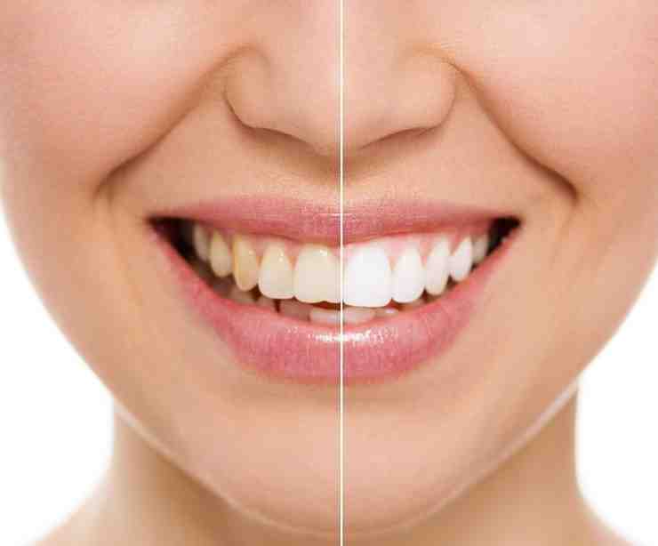 What is the difference between a dentist and a cosmetic dentist?