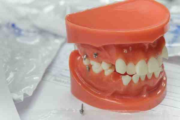 What is the success rate of mini dental implants?