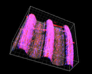 Who makes Nobel Biocare implants?