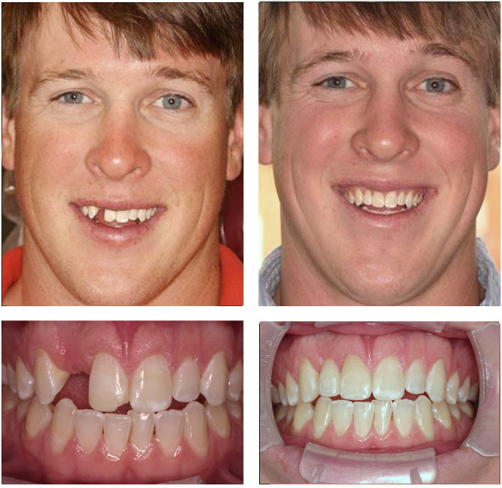 Who qualifies for dental treatment free?