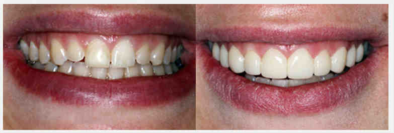 Why cosmetic dentistry is bad?