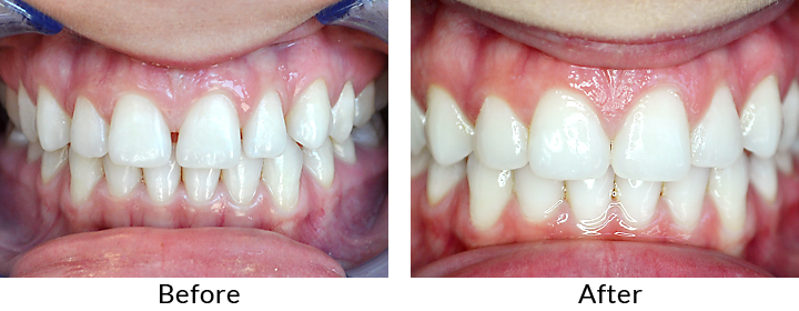 Why cosmetic dentistry is bad?