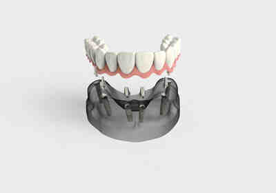 Why does wearing dentures shorten your lifespan?