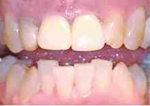 Why is Poconos so popular?