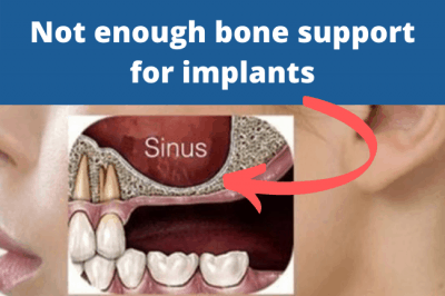 Why is my dental implant hurting?