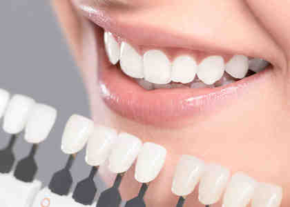 Will Medicaid pay for permanent dentures?