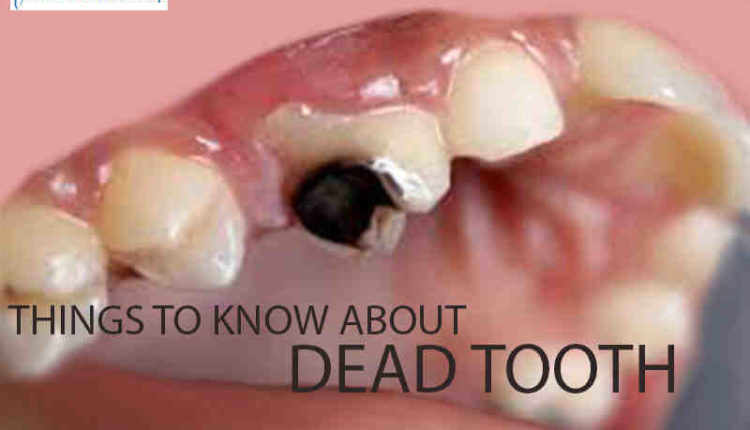 can-a-dental-implant-fall-out-within-24-hrs-of-being-put-in-dental