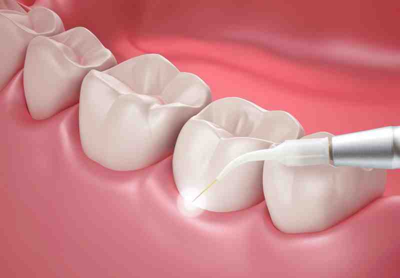 Cosmetic gum dentistry Dental News Network