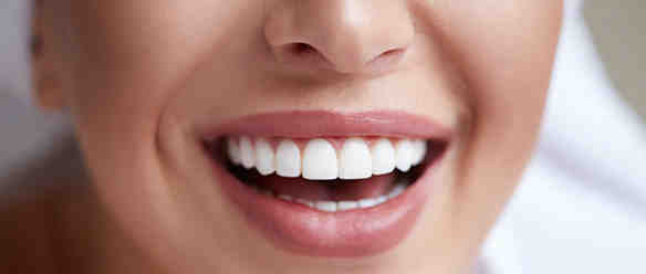 Can you get cosmetic gum surgery?