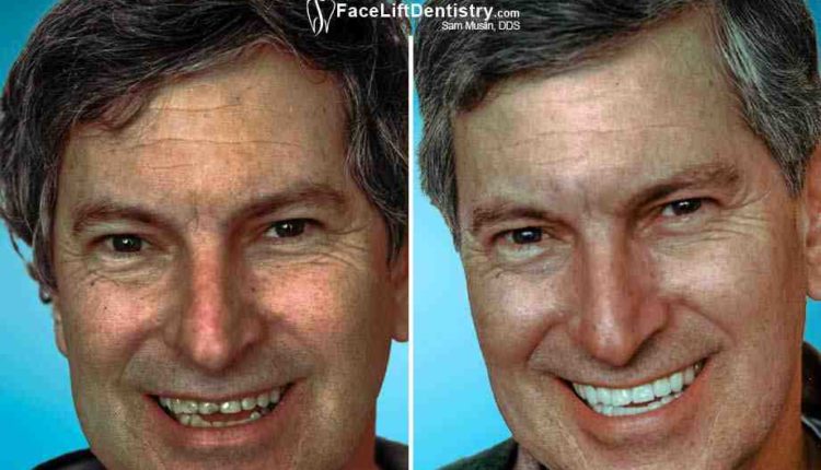 Can you use cushion grip if you have a dental implant