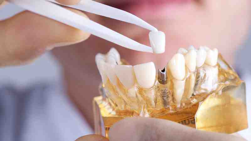 Can you use denture adhesive with implants?
