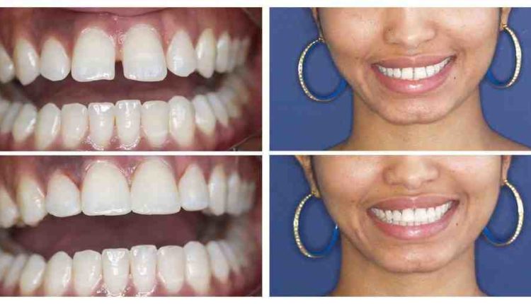 Cosmetic dentistry, maine