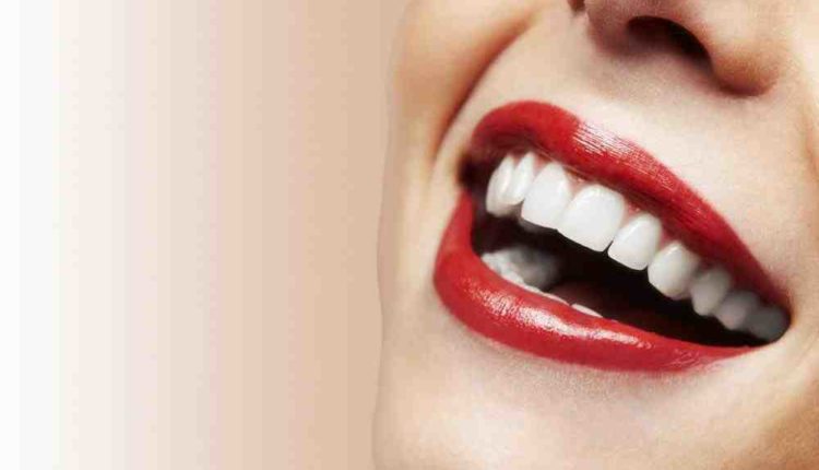 Cosmetic dentistry veneer washington dc reiews