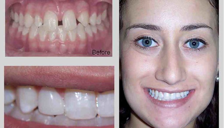 Cosmetic dentistry wellington fl