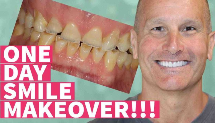 Cosmetic dentistry, where to start