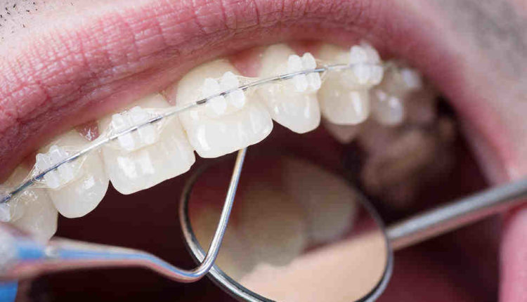 Cosmetic dentistry with all applicants