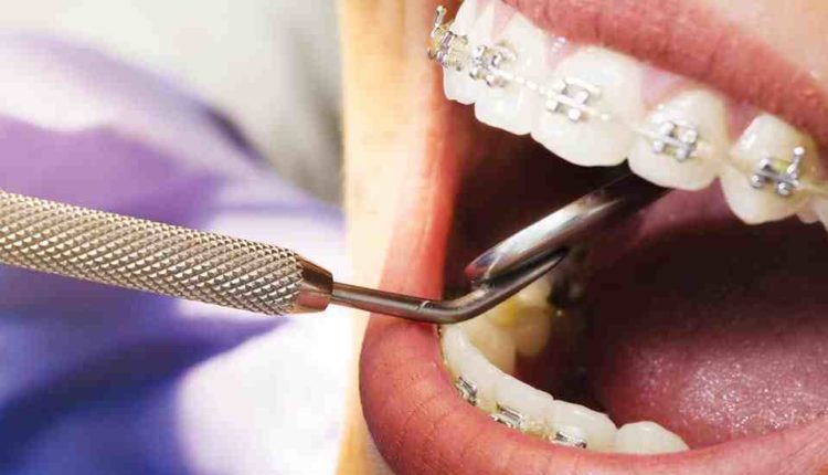 Cosmetic dentistry years of school