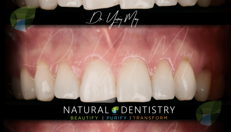 Cosmetic pediatric dentistry san diego medical