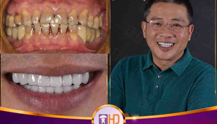 Cosmetic surgery in dentistry