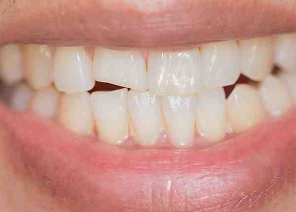 Cost of cosmetic dentistry in tenessee