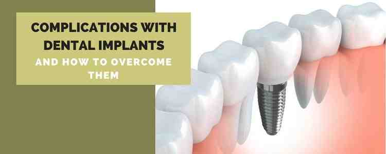 Do dental implants feel strange at first?