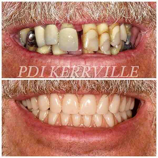 Do most dentists accept Delta Dental?