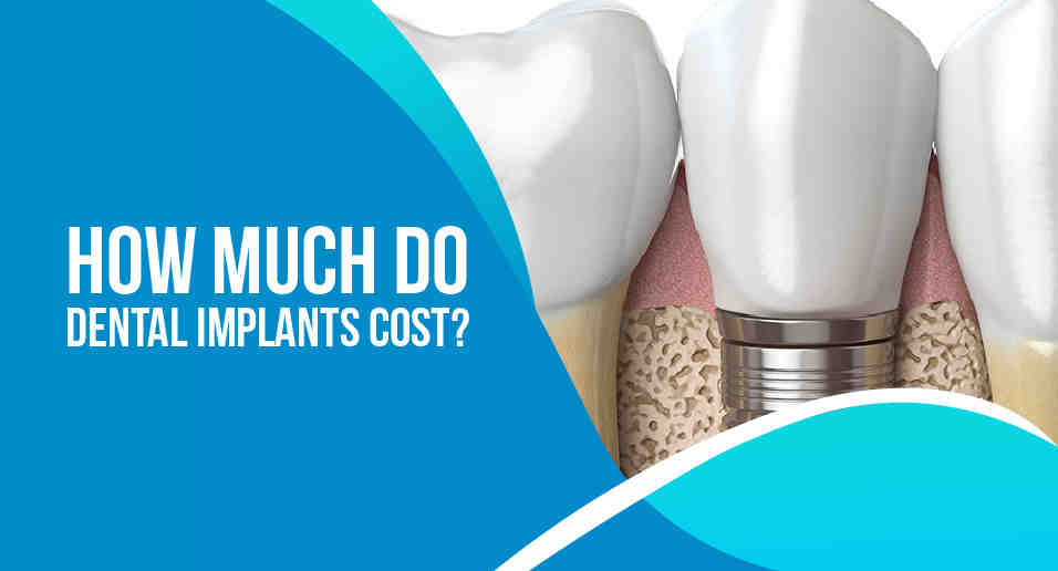 What medicare plans cover dental implants Dental News Network