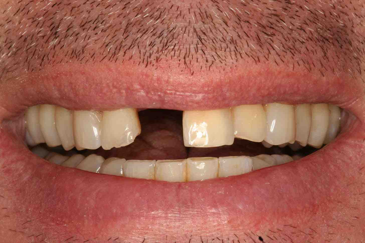 Cosmetic dentistry, implants & braces Dental News Network