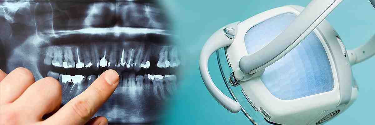 How can I get money for dental implants?