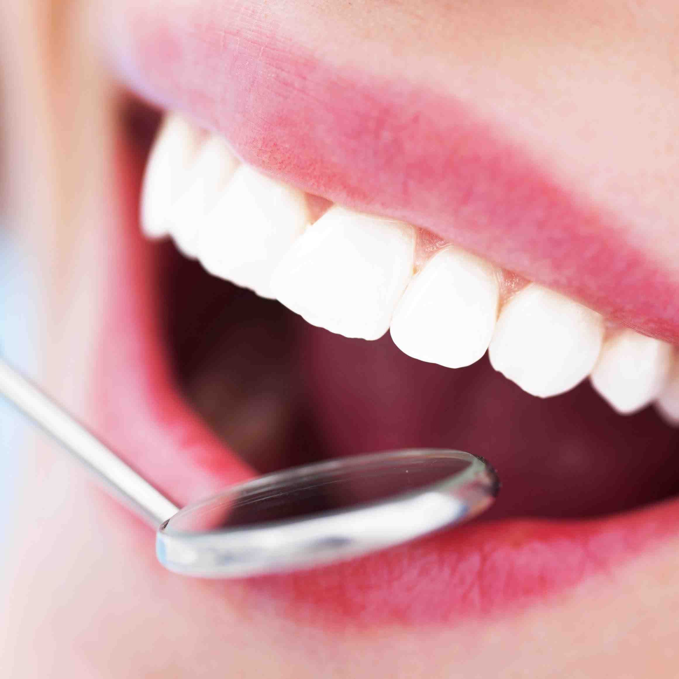 How do I find a good cosmetic dentist UK?