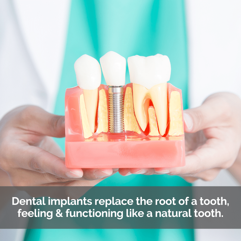 What does it feel like to have dental implants Dental News Network