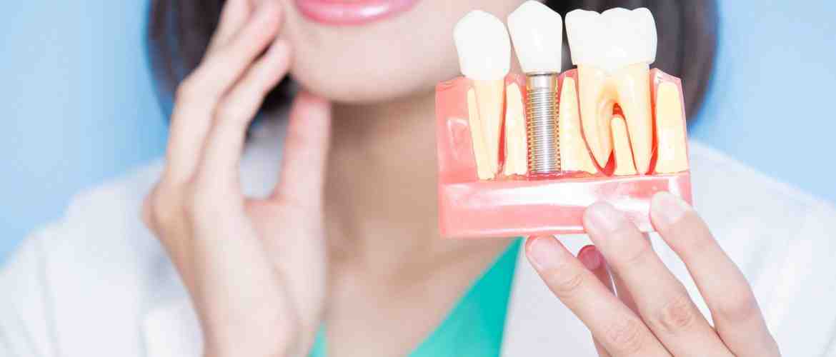 How is dental implants done?