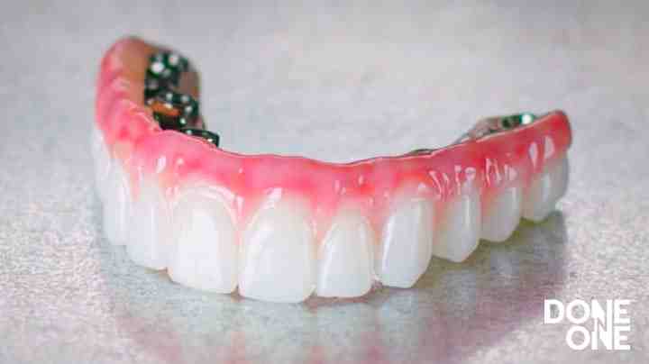 How many general dentists put implants?