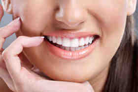 How many teeth are in a full set of implants?